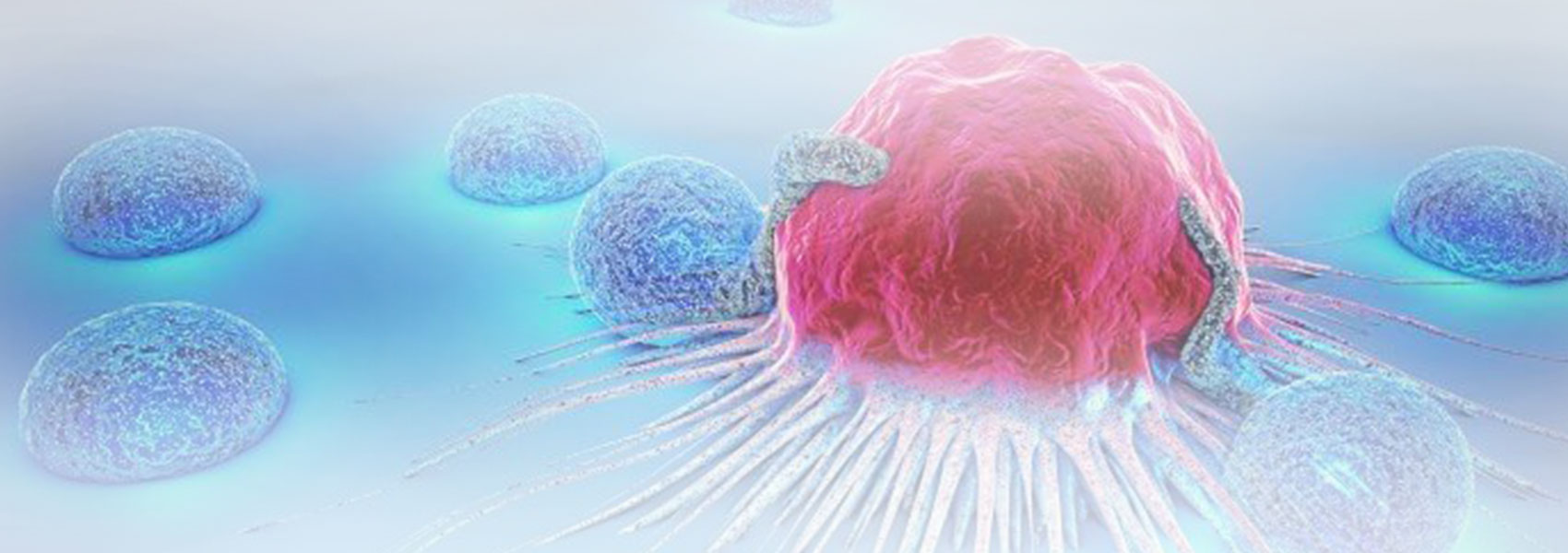 Cancer-Diagnosis-Malpractice-main