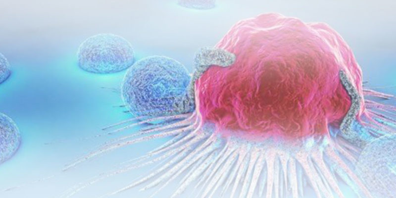 Cancer-Diagnosis-Malpractice